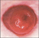Estoma